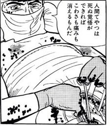 高須克弥院長が衝撃告白！「自分の手術は自分でする」「面倒くさいときは麻酔しません」
