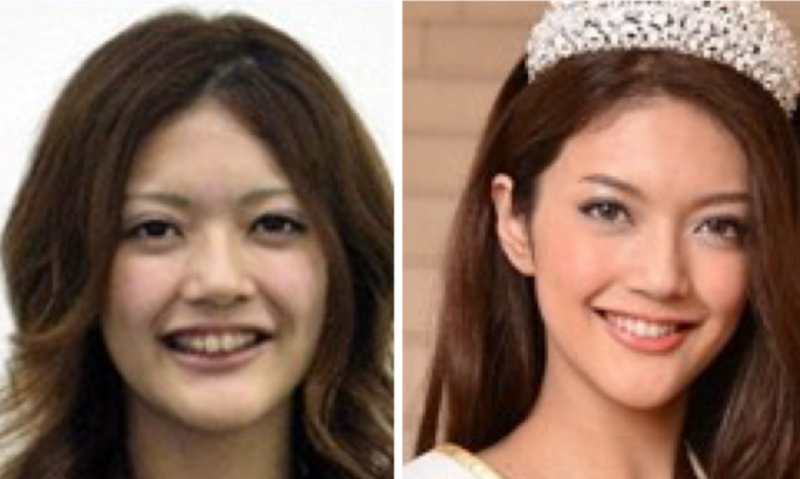 顔が変わりすぎて「iPhoneが同一人物だと認識できない」 総額1300万整形アイドル、美容整形の思わぬ弊害告白