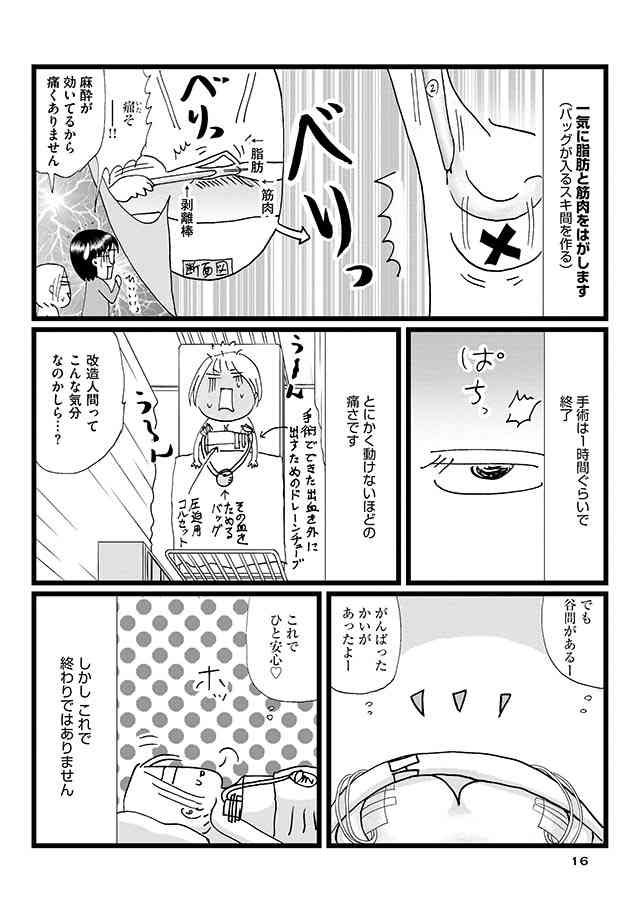 豊胸手術に興味がある人、または経験者の方！