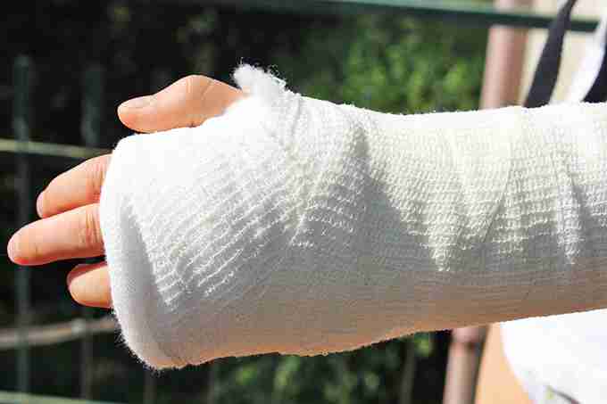 骨折した事がある人！