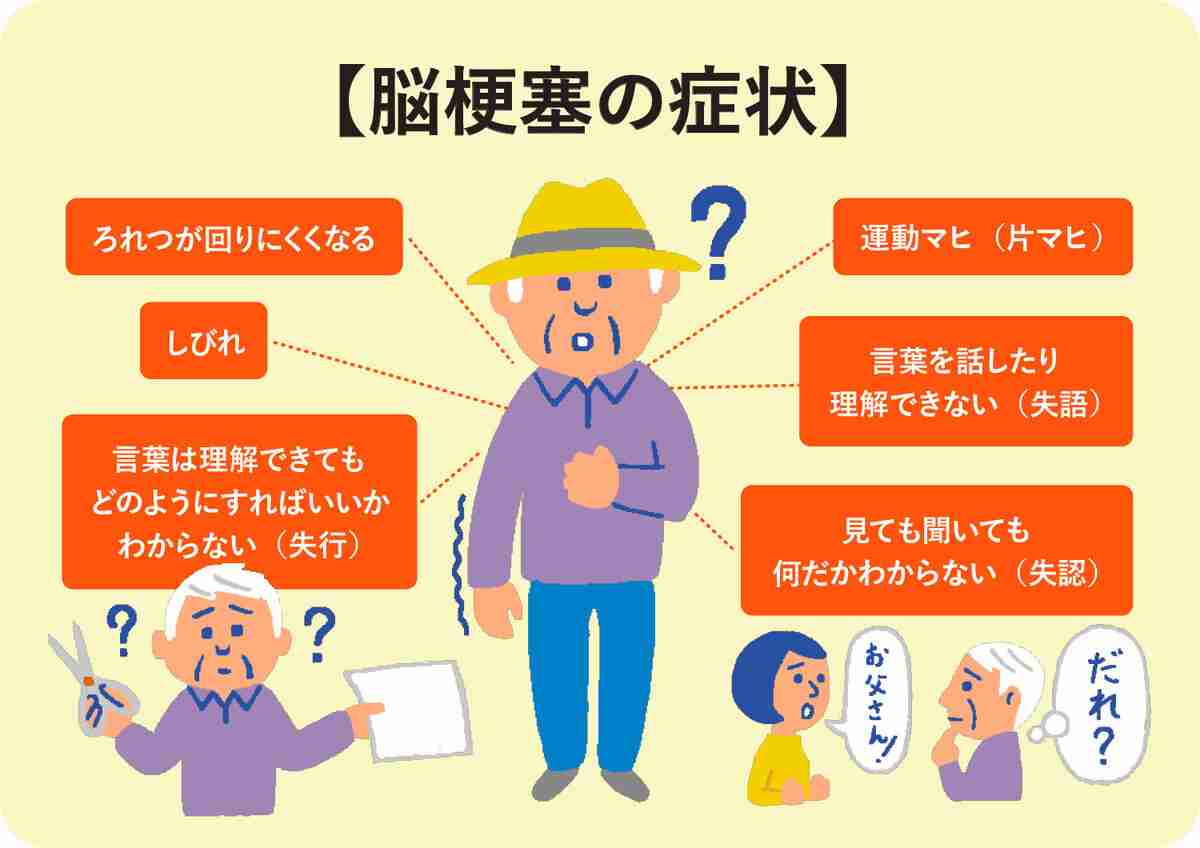 脳出血について