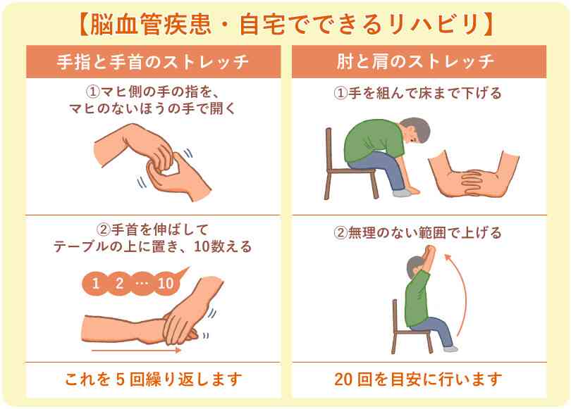 脳出血について