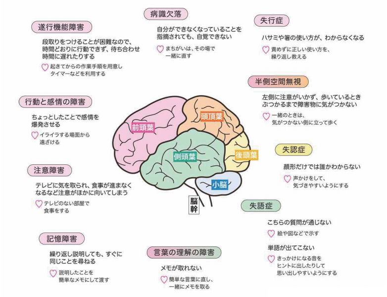 脳出血について