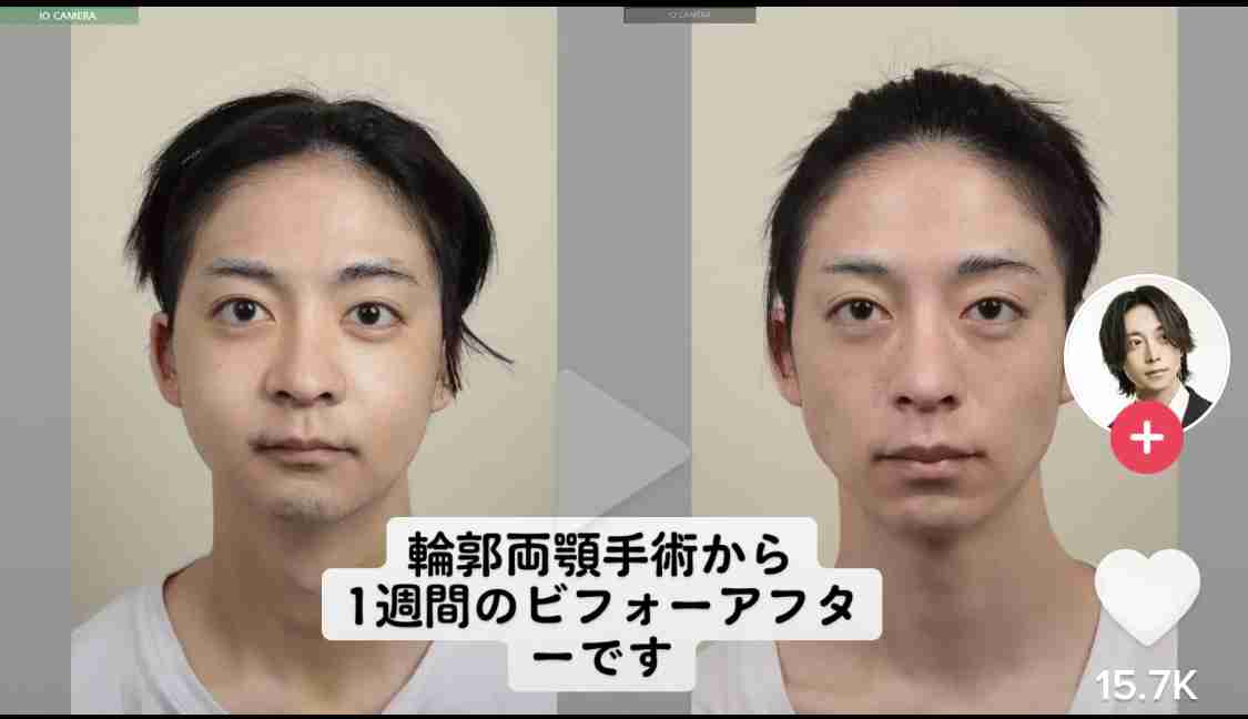 ホストのぶっちゃけ話!「1200万円かけ整形」「50代女性に奪われた」:じっくり聞いタロウ