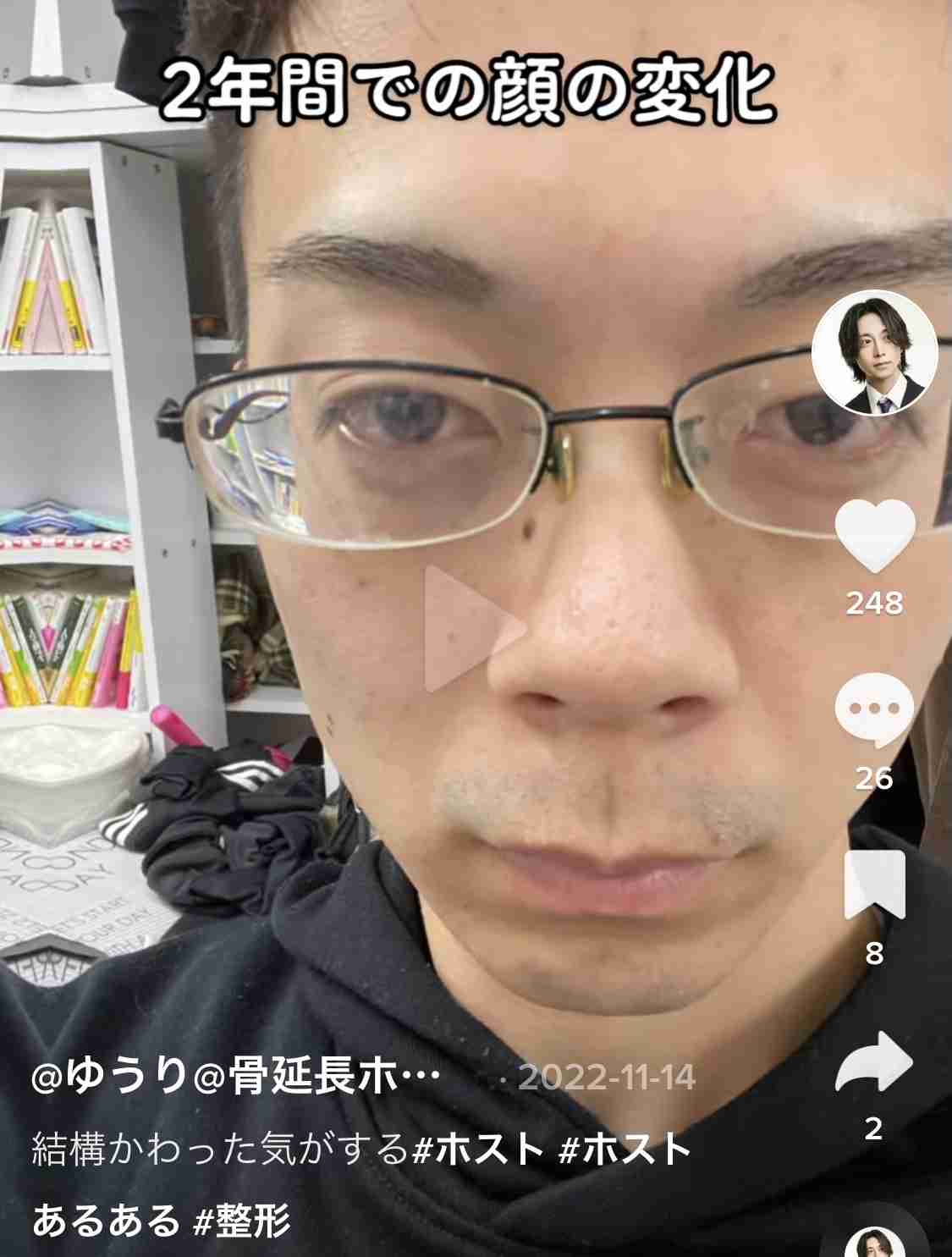 ホストのぶっちゃけ話!「1200万円かけ整形」「50代女性に奪われた」:じっくり聞いタロウ