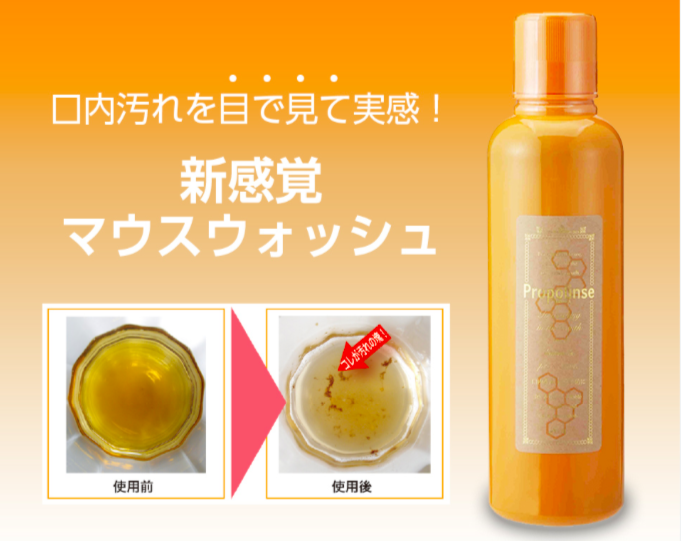 【お口】口臭外来通ったことある方【ケア方法】