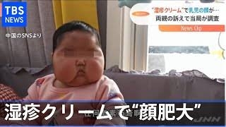中国人の解熱剤「爆買い」阻止へ、ドラッグストアに個数制限など要請…厚労省