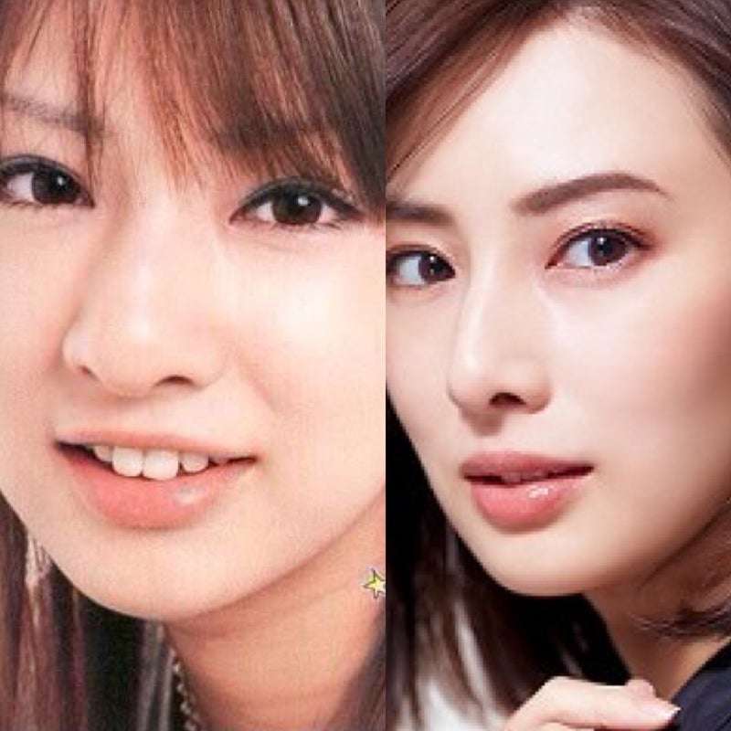 当時より垢抜けたなーと思う有名人