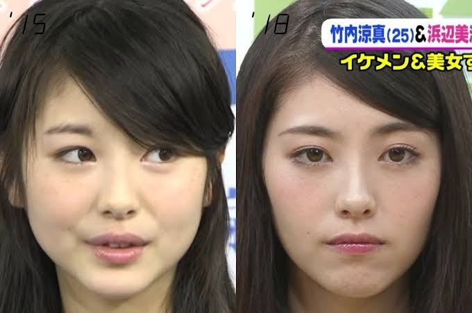 当時より垢抜けたなーと思う有名人