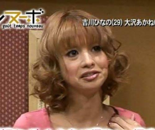 当時より垢抜けたなーと思う有名人