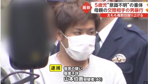 5歳児が脳死状態　母親の交際相手の男、「4回蹴った」