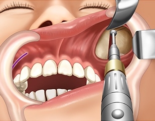 猫の“死骸”が小学校の鉄棒に　近くの公園でも切断された足が　さいたま市