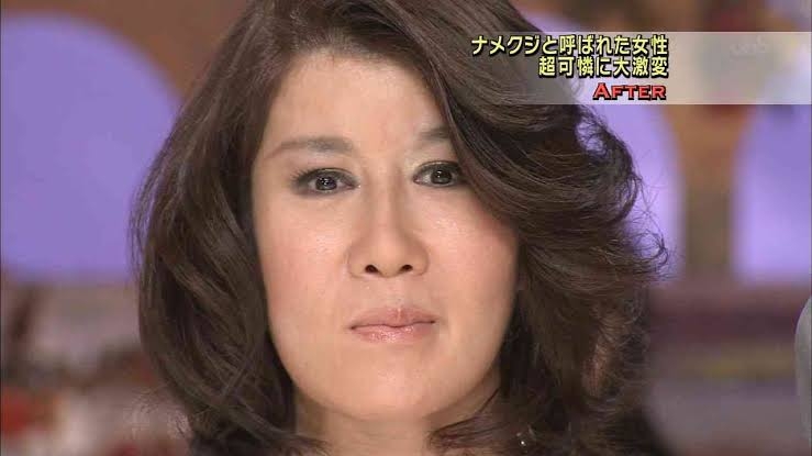 「整形して人生変わった」　人気インフルエンサーがビフォーアフター公開...激変ぶりにファン騒然「別人やん」