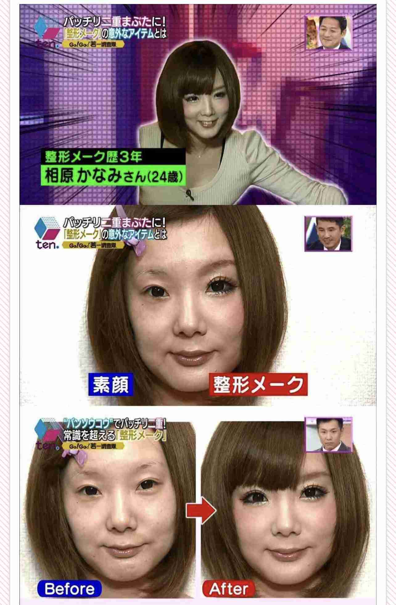 「整形して人生変わった」　人気インフルエンサーがビフォーアフター公開...激変ぶりにファン騒然「別人やん」