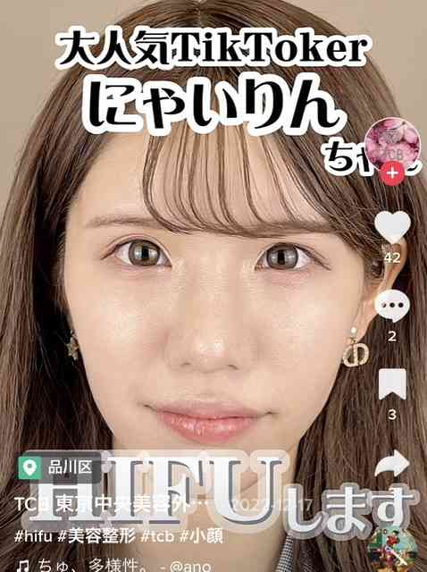 「整形して人生変わった」　人気インフルエンサーがビフォーアフター公開...激変ぶりにファン騒然「別人やん」
