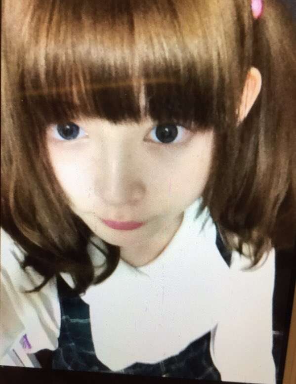 1700万整形モデルが「後悔した整形」4つ告白　「120万円損した」「本当に無駄だった」