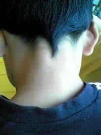 うなじの形が気に入らない