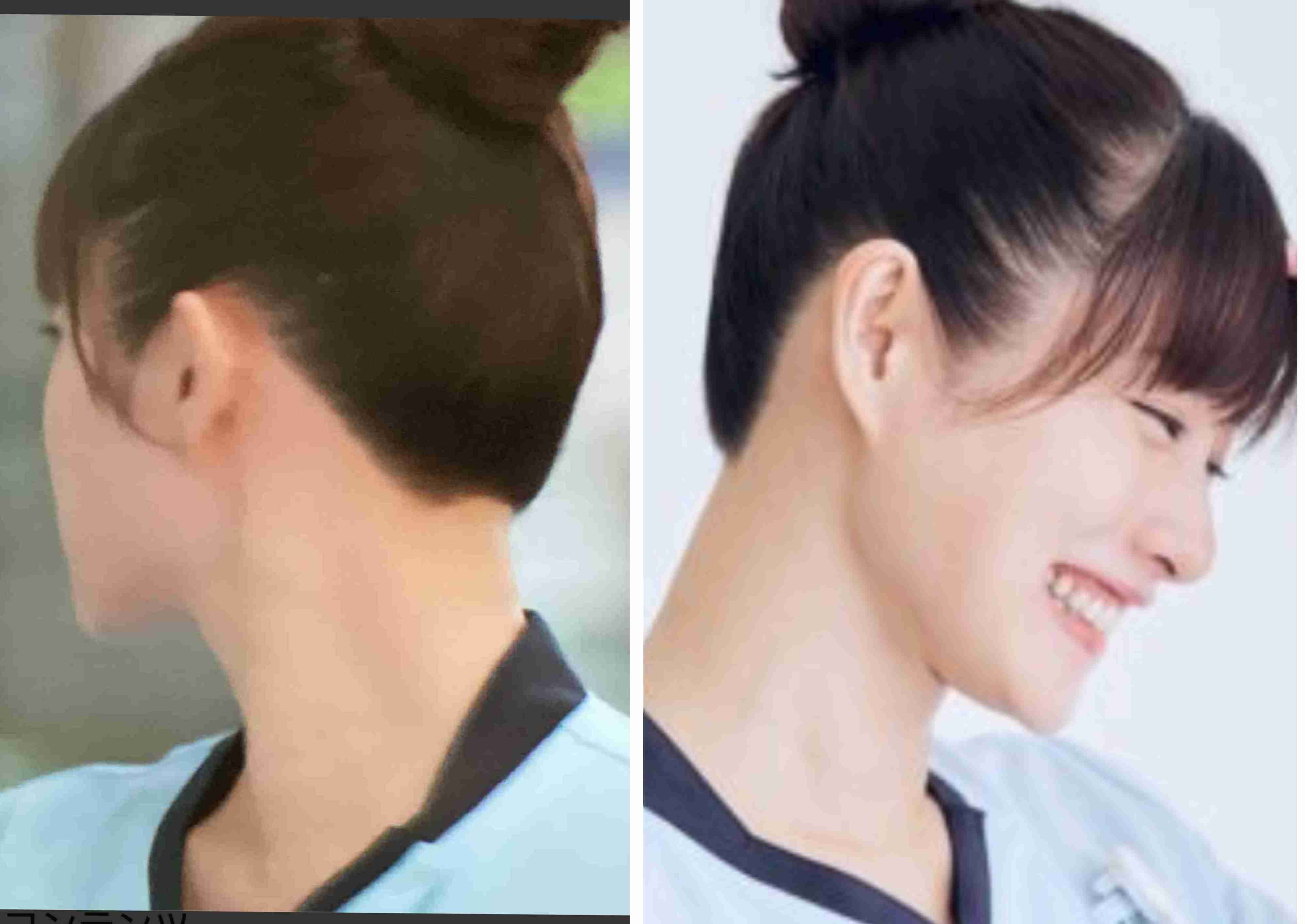 うなじの形が気に入らない