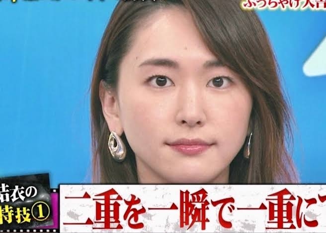 米国で活躍するモデル、日本の10代向け二重整形に問題提起「整形をしないと価値がないような脅しやめて」