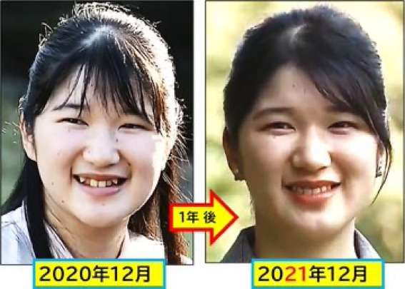 米国で活躍するモデル、日本の10代向け二重整形に問題提起「整形をしないと価値がないような脅しやめて」