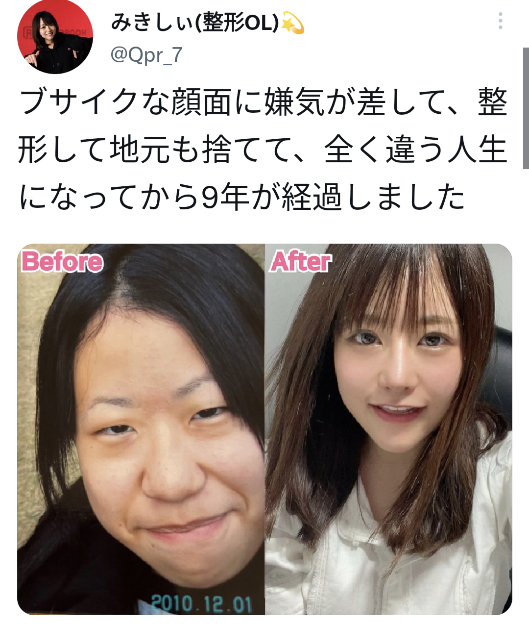 米国で活躍するモデル、日本の10代向け二重整形に問題提起「整形をしないと価値がないような脅しやめて」