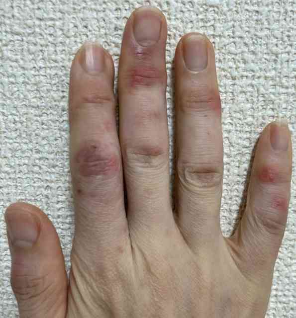 【節電】冷え性・寒がりの人、体調大丈夫ですか？