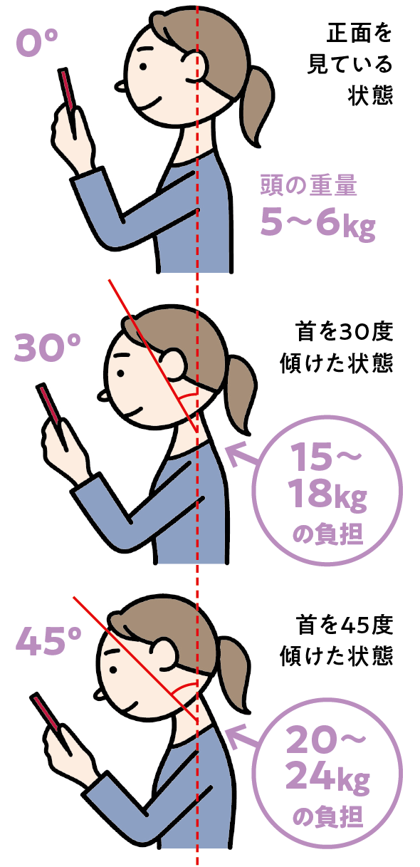 ストレートネックの人いますか？