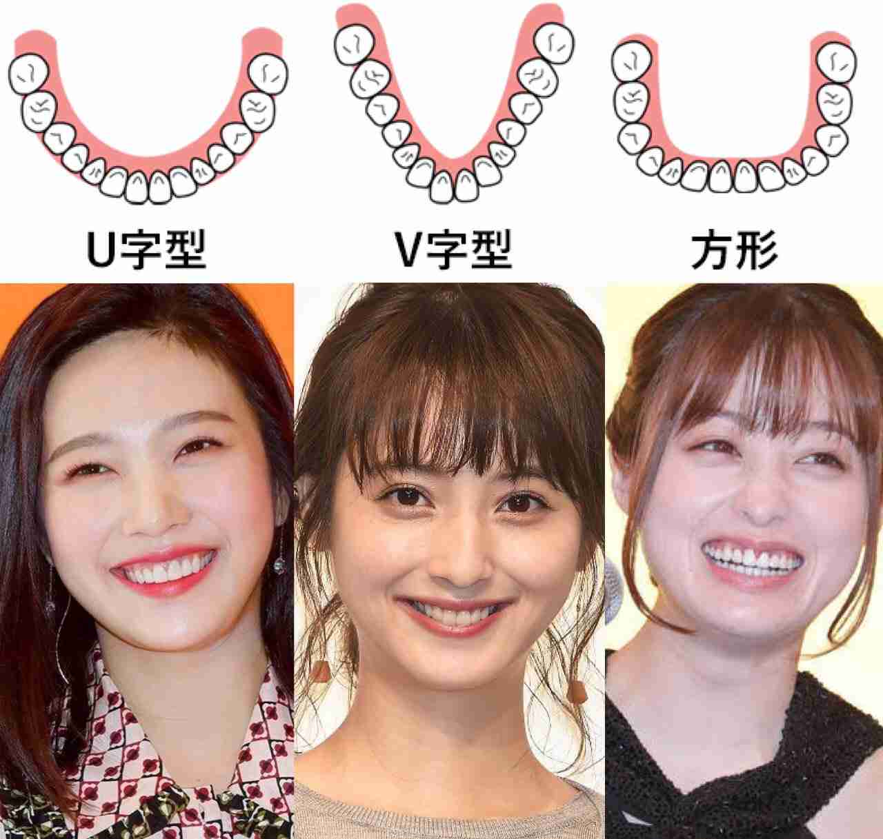 歯について色々聞いて誰かが答えてくれるトピ