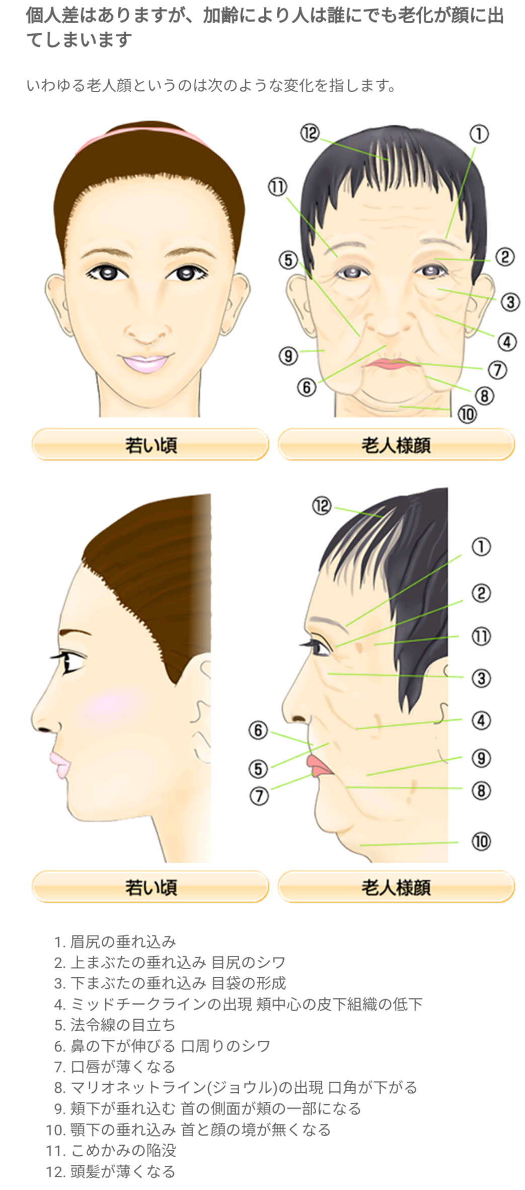 加齢で変わった顔の場所