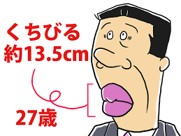 整形で“世界一大きな唇”を手に入れた女性が「醜い」「気持ち悪い」と批判されるも「次は世界一大きな頬骨がほしい」とやる気