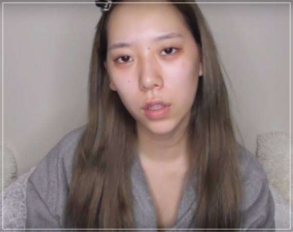 24歳の新婚ユーチューバー、家族で美容整形に「結婚式までにどうにかしないと」仕上がりに称賛の声