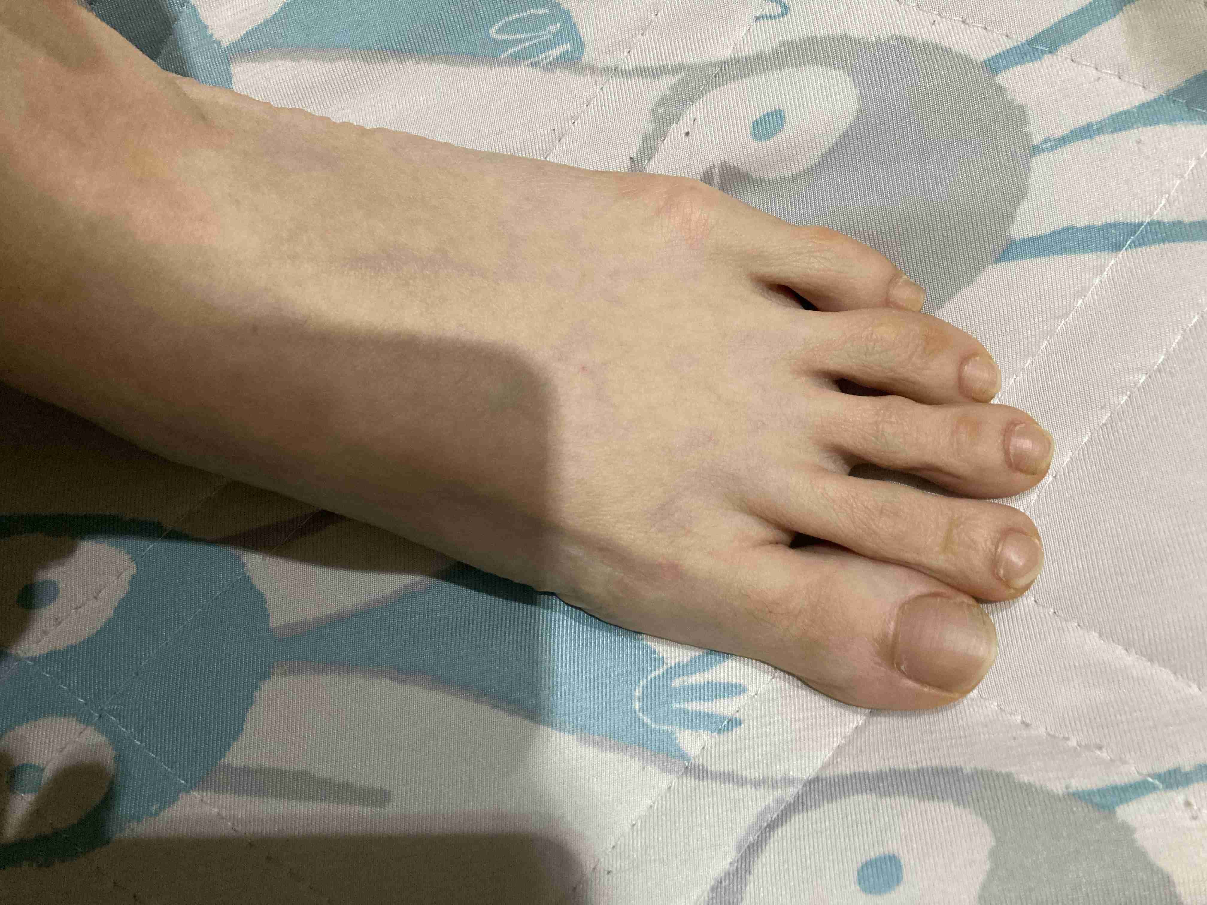 足の指が長い人
