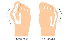 足の指が長い人