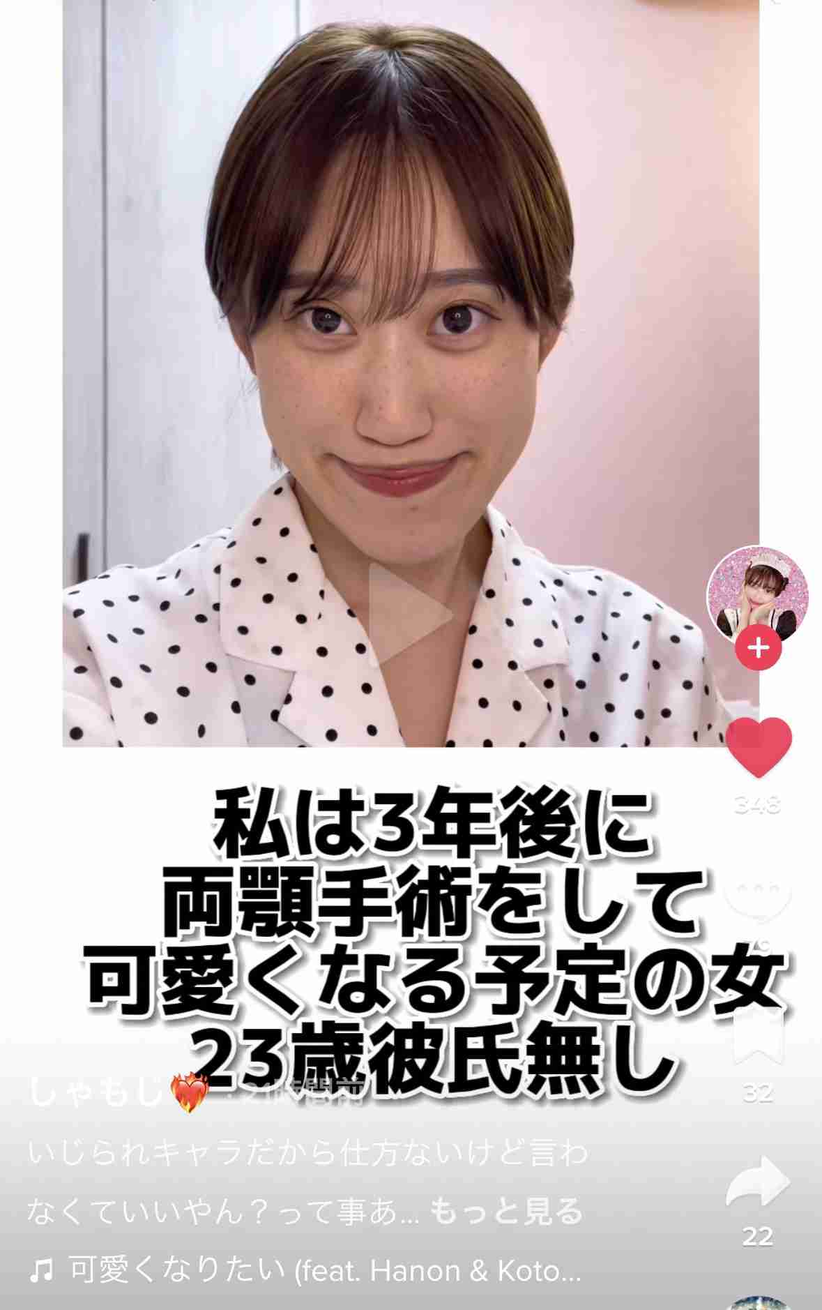 【トラウマ】整形依存の人集まれ！【醜形恐怖症】