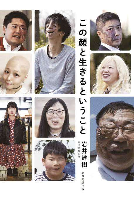 生まれつき鼻と口に変形がある私 「表に出ては駄目」から「隠れなくていいんだ」に変わった理由