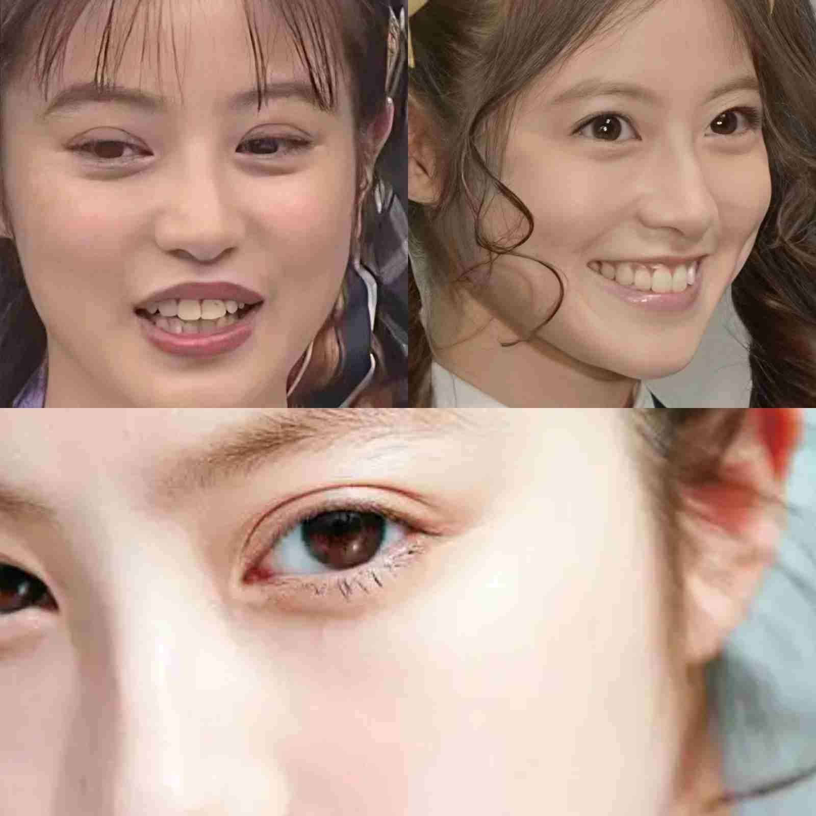 美容外科医が明かす患者が「この顔に」と希望する芸能人ランキング　佐々木希3位、橋本環奈2位、1位は？