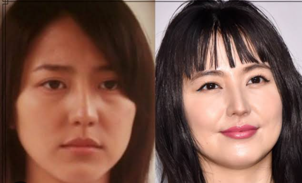 美容外科医が明かす患者が「この顔に」と希望する芸能人ランキング　佐々木希3位、橋本環奈2位、1位は？