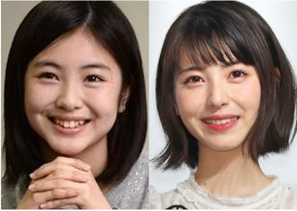 美容外科医が明かす患者が「この顔に」と希望する芸能人ランキング　佐々木希3位、橋本環奈2位、1位は？