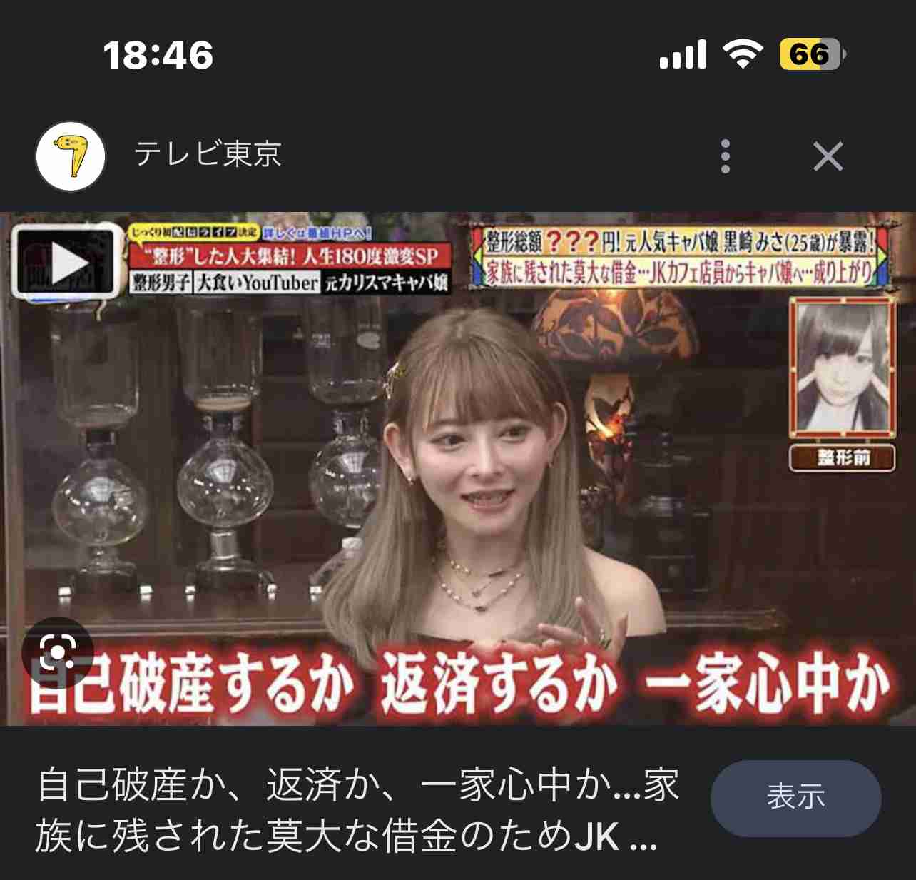 整形総額1700万円 双子の母・黒崎みさ、若気の至りで入れたタトゥーに後悔「除去する予定です」