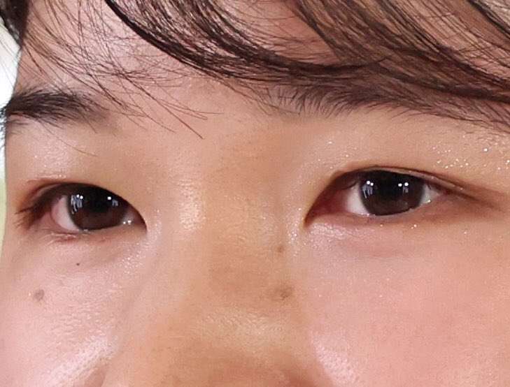 アイプチ愛用してる人