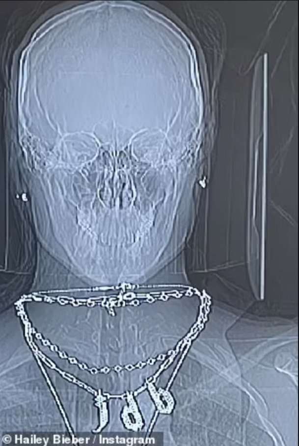 ジャスティン・ビーバーの妻、“心臓手術”成功に感謝