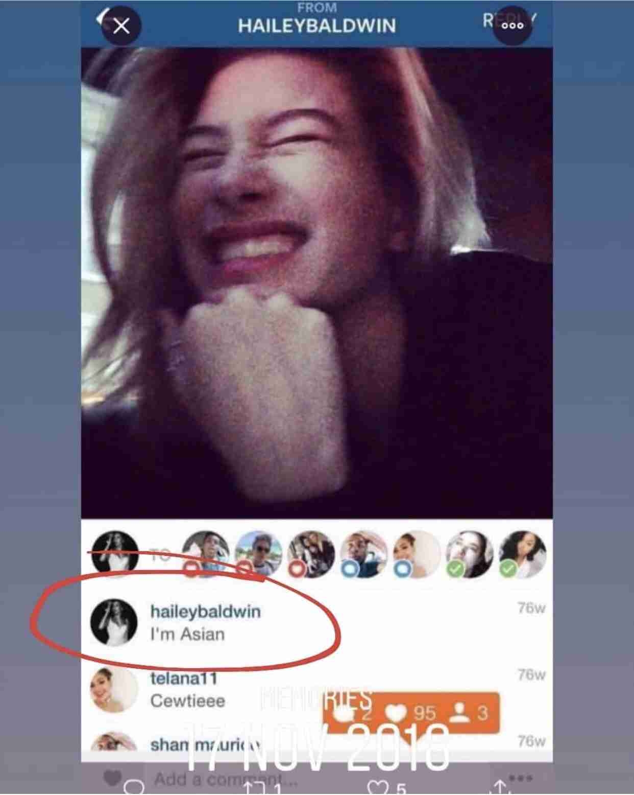 ジャスティン・ビーバーの妻、“心臓手術”成功に感謝