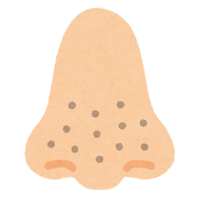 いちご鼻をなんとかしたい