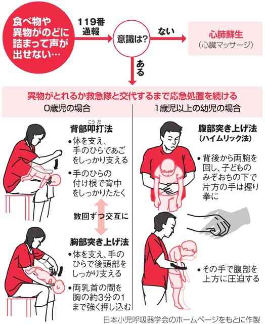 生後8か月の男の子　保育所でリンゴを食べた直後、一時、心肺停止状態　のどにつまらせたか？現在も意識不明の重体