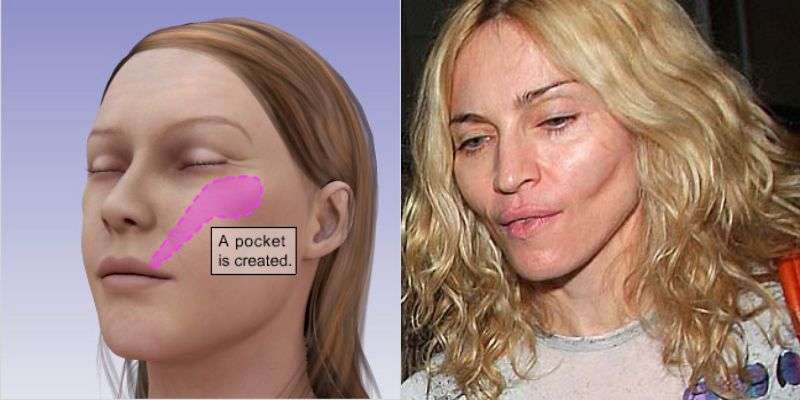 『恋人たちの予感』メグ・ライアンが久々に公の場に！すぐさまネットで注目を浴びる「顔に何をした？」「本当にメグ・ライアン？」