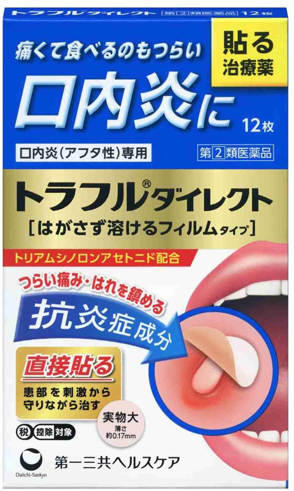 口内炎におすすめの薬