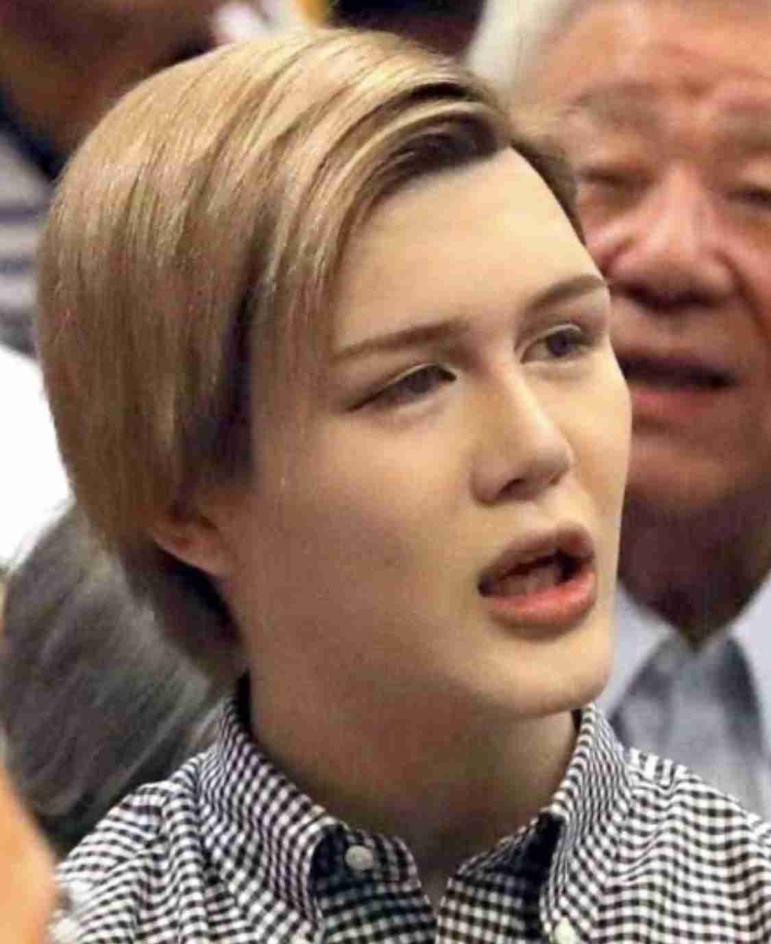 Matt、アゴにヒアルロン酸大量注入で異変→遅発性結節に 現在は思わぬ変化「入れ直して…いい感じ」