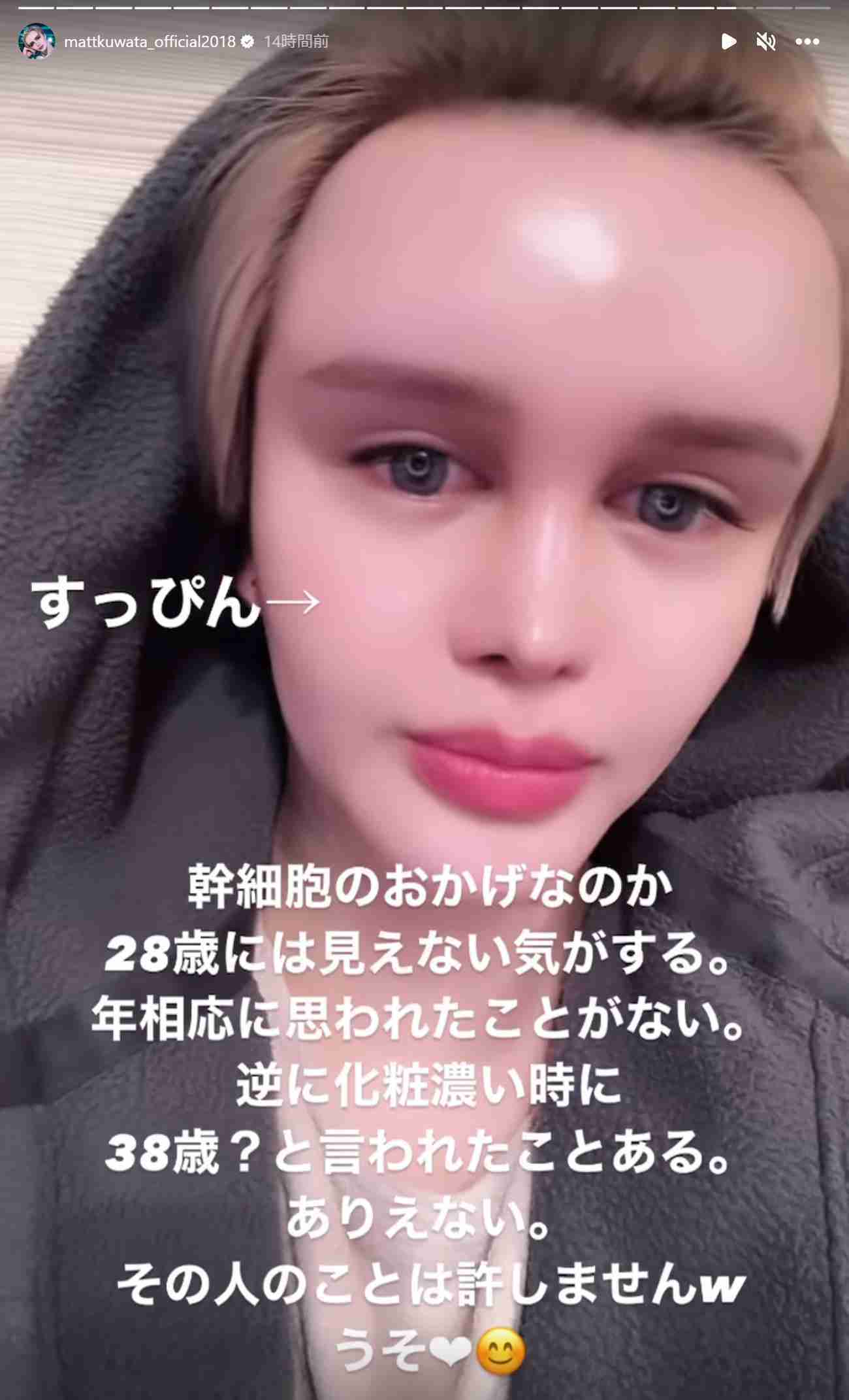 Matt、アゴにヒアルロン酸大量注入で異変→遅発性結節に 現在は思わぬ変化「入れ直して…いい感じ」