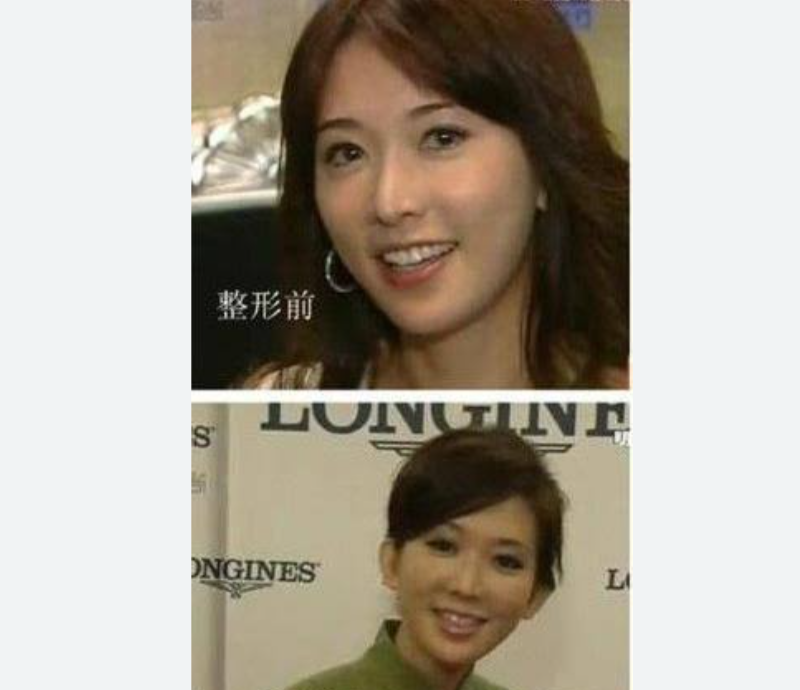 整形1350万アイドルに「子供産んだ時が楽しみだね！笑」　容姿めぐり壮絶中傷…「これが私の日常だった」
