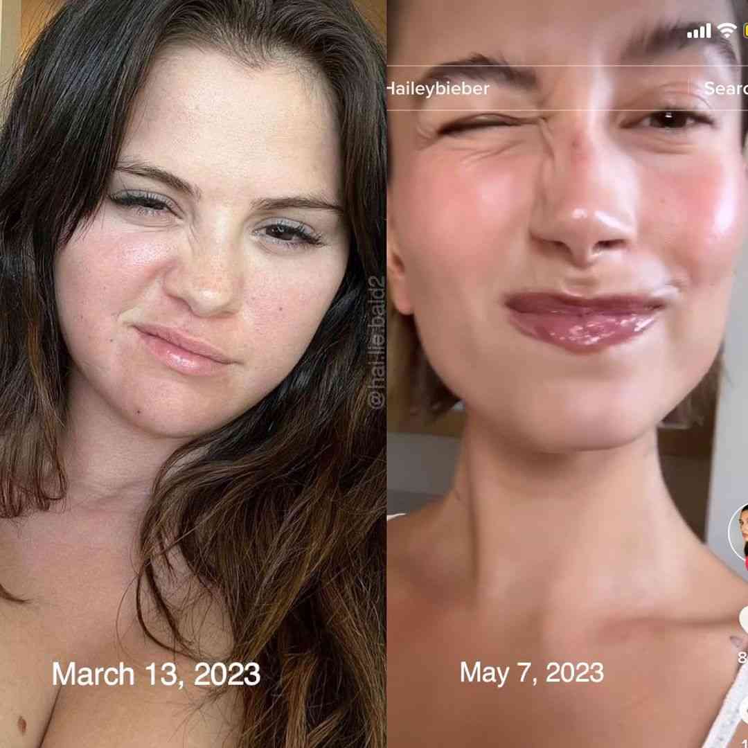 ジャスティン・ビーバーの妻、“心臓手術”成功に感謝